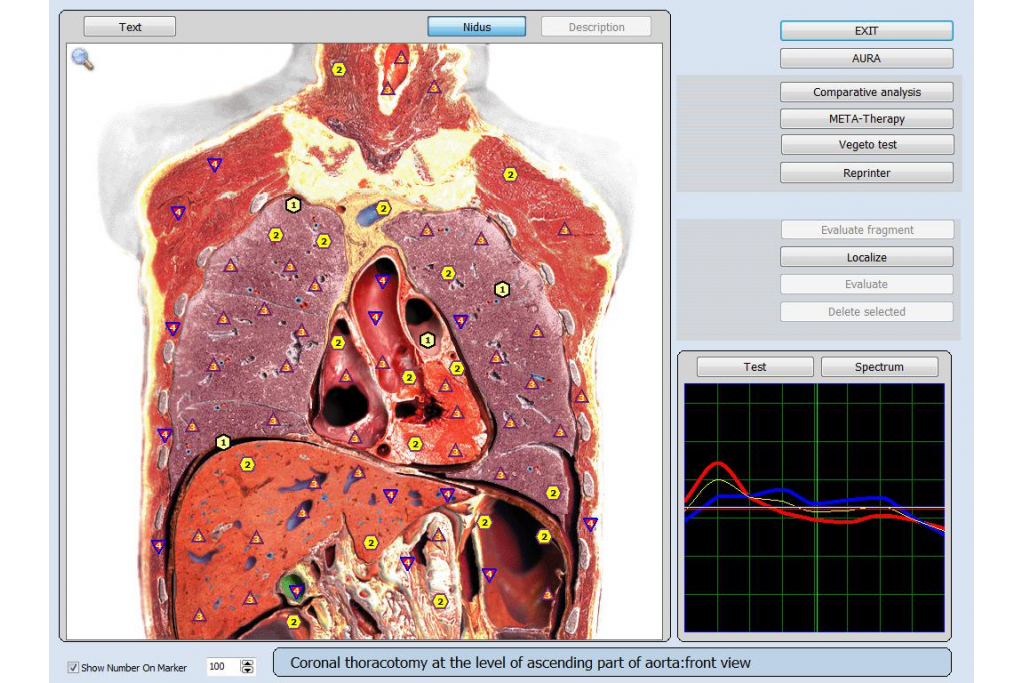 Bioplasm-NLS Full-Body Health Detection & Energy Repair: An All-In-One Precision Health Management Solution