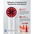 Portable Handheld Pain Relief Laser  Device