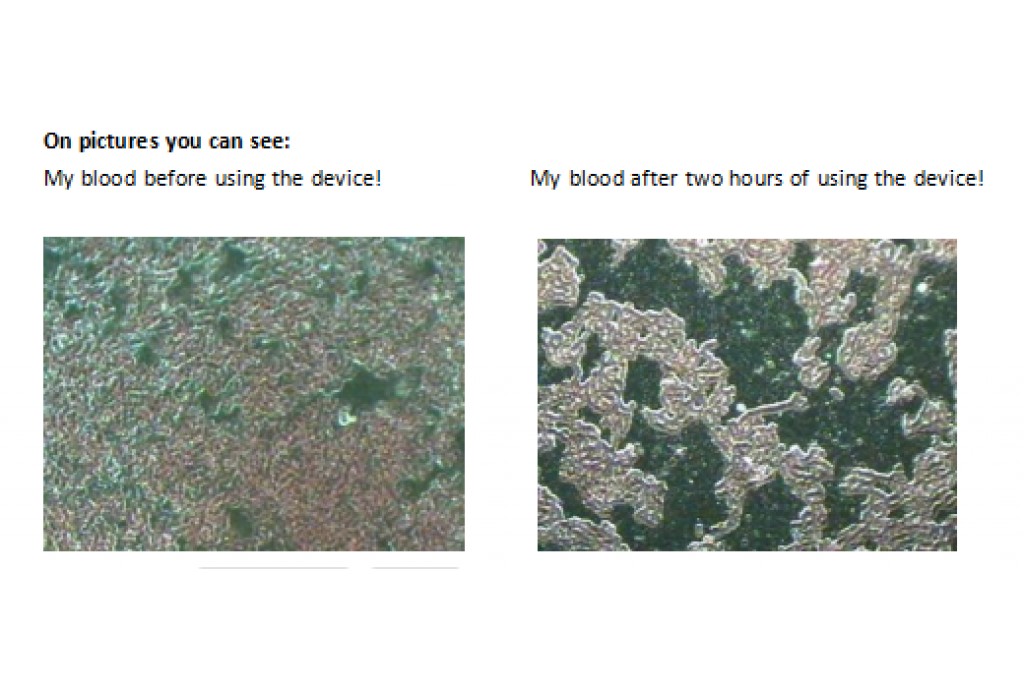 Unveiling the RIFE Power Bugs Zapper: How Does It "Zap" Pathogens？
